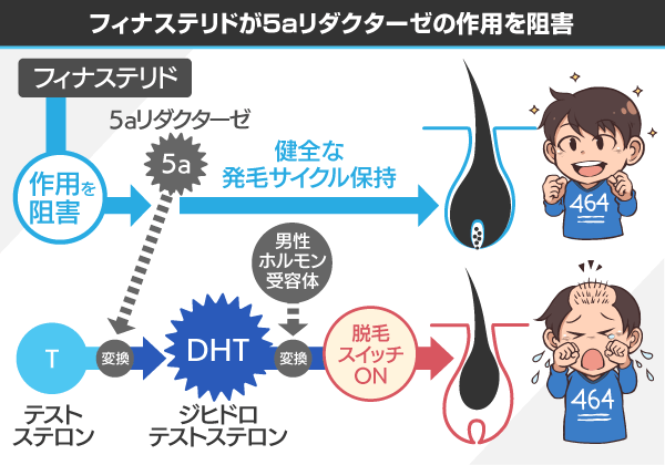 フィナステリドの効果