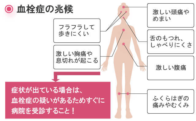 血栓症の兆候